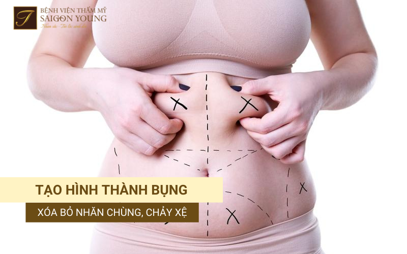 Tạo hình thành bụng